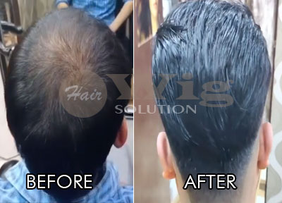 Hair Wig Nagpur Sale, 58% OFF 