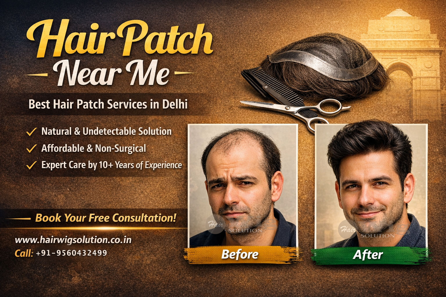 Hair Patch Service in Delhi – Natural & Non-Surgical Hair Solution for Men